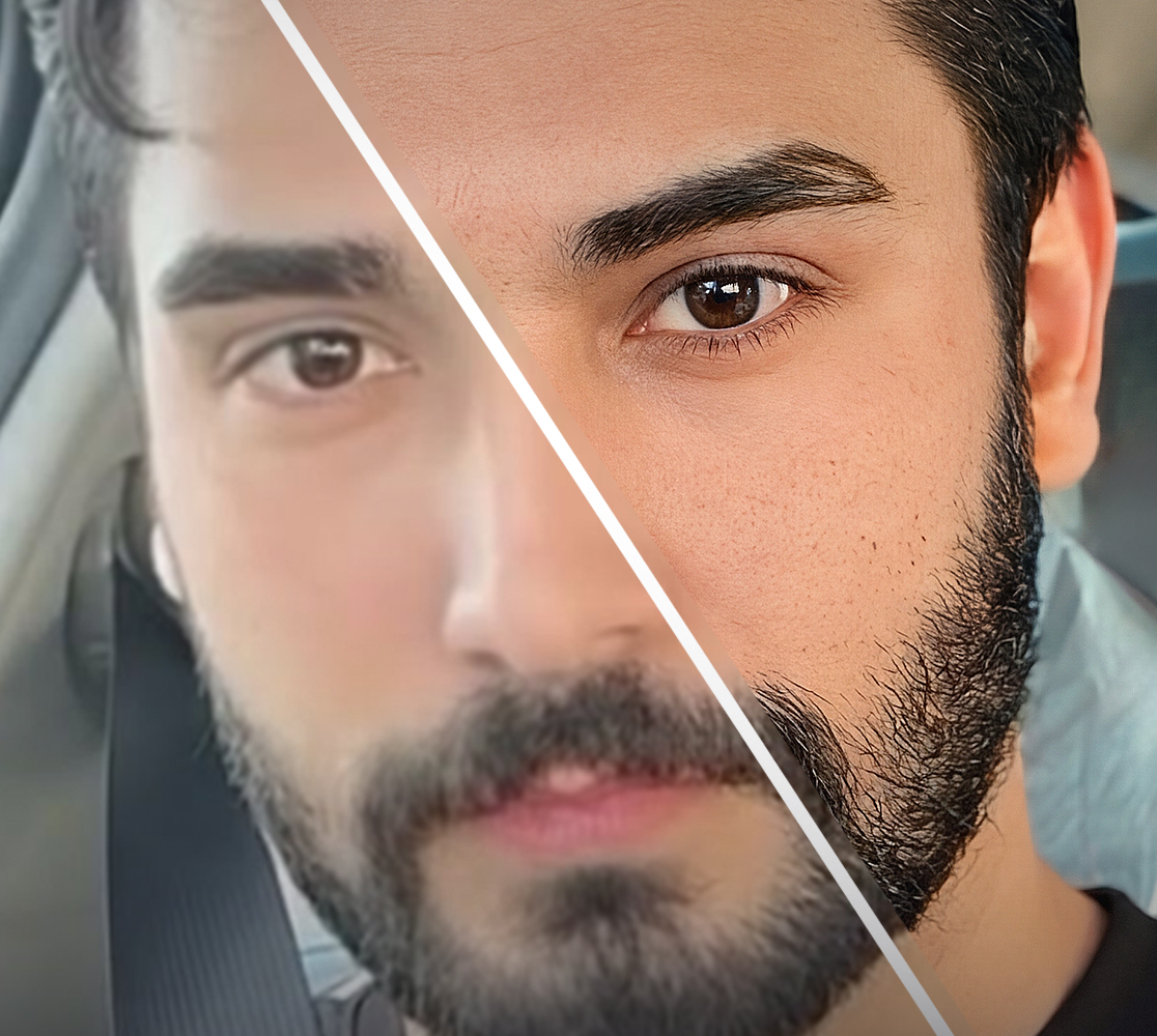 رفع دقة الصور بشكل واقعي