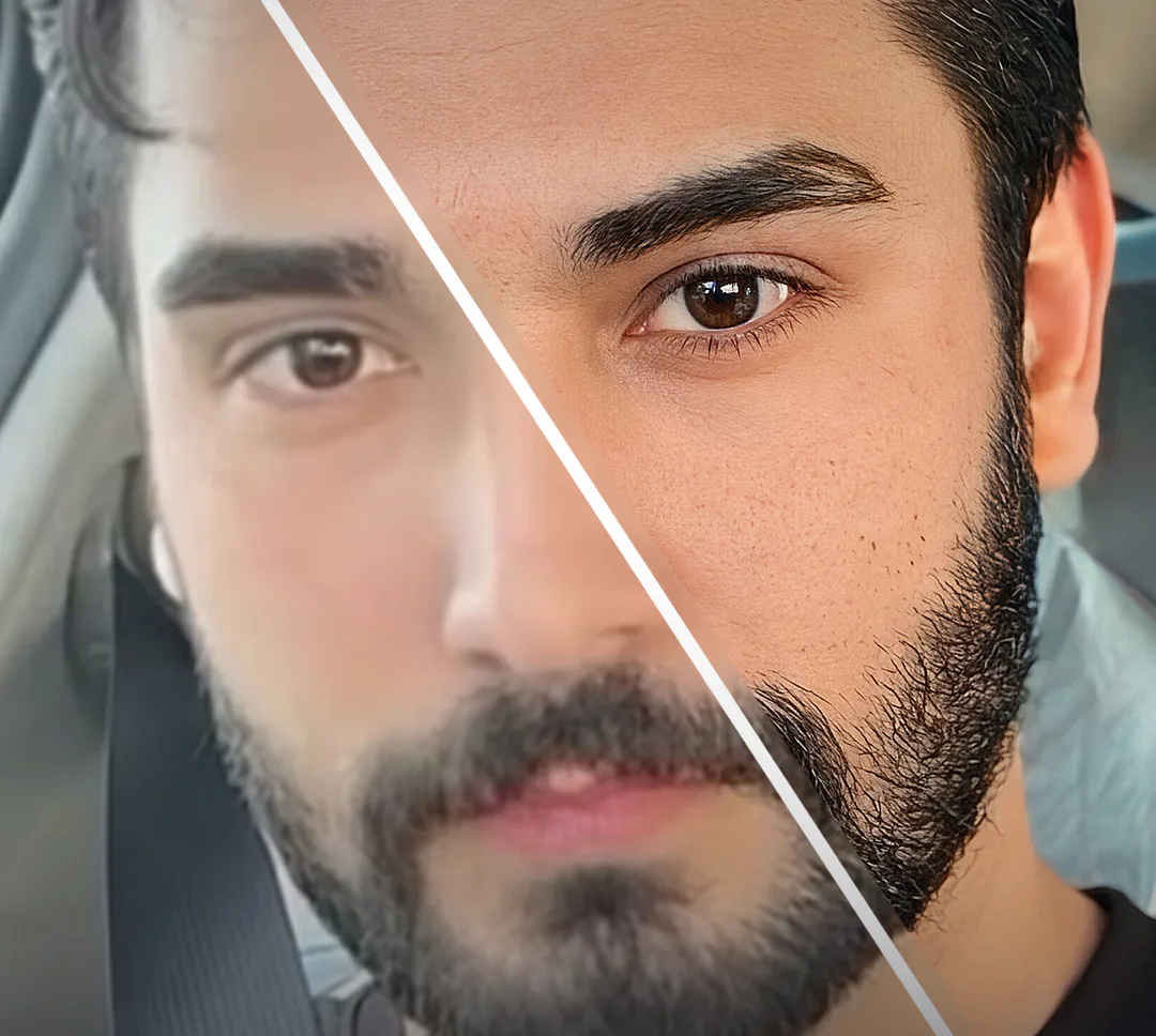 رفع دقة الصور بشكل واقعي